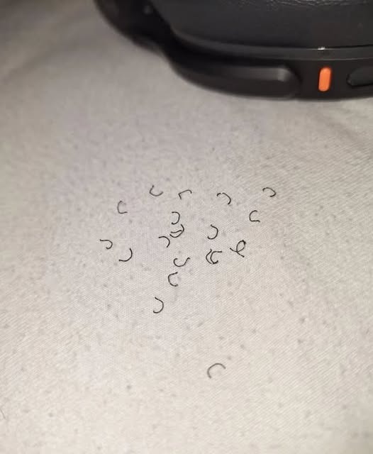 Woke Up to Tiny Shavings on Your Bed? The Real Reason Might Surprise You