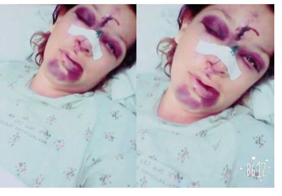 VERY SAD News: Young woman dies at the hands of her…
