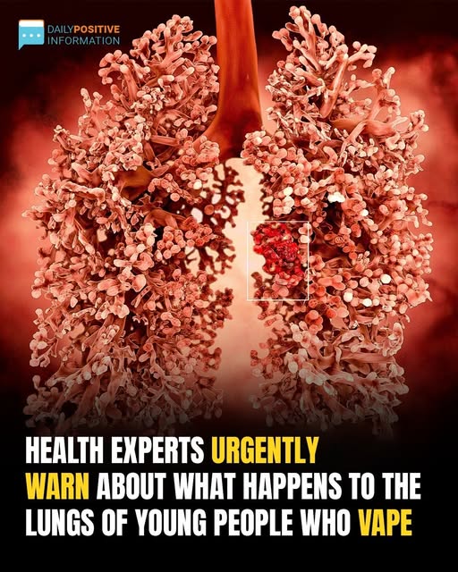 Teen Vaping Crisis: Doctors Warn of “Popcorn Lung” Sending Kids to the ER