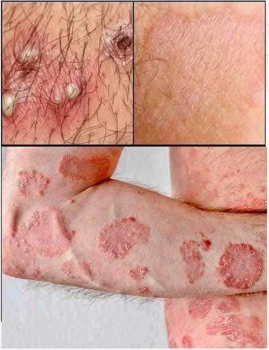 HT10. These are the signs that he is cr… See more