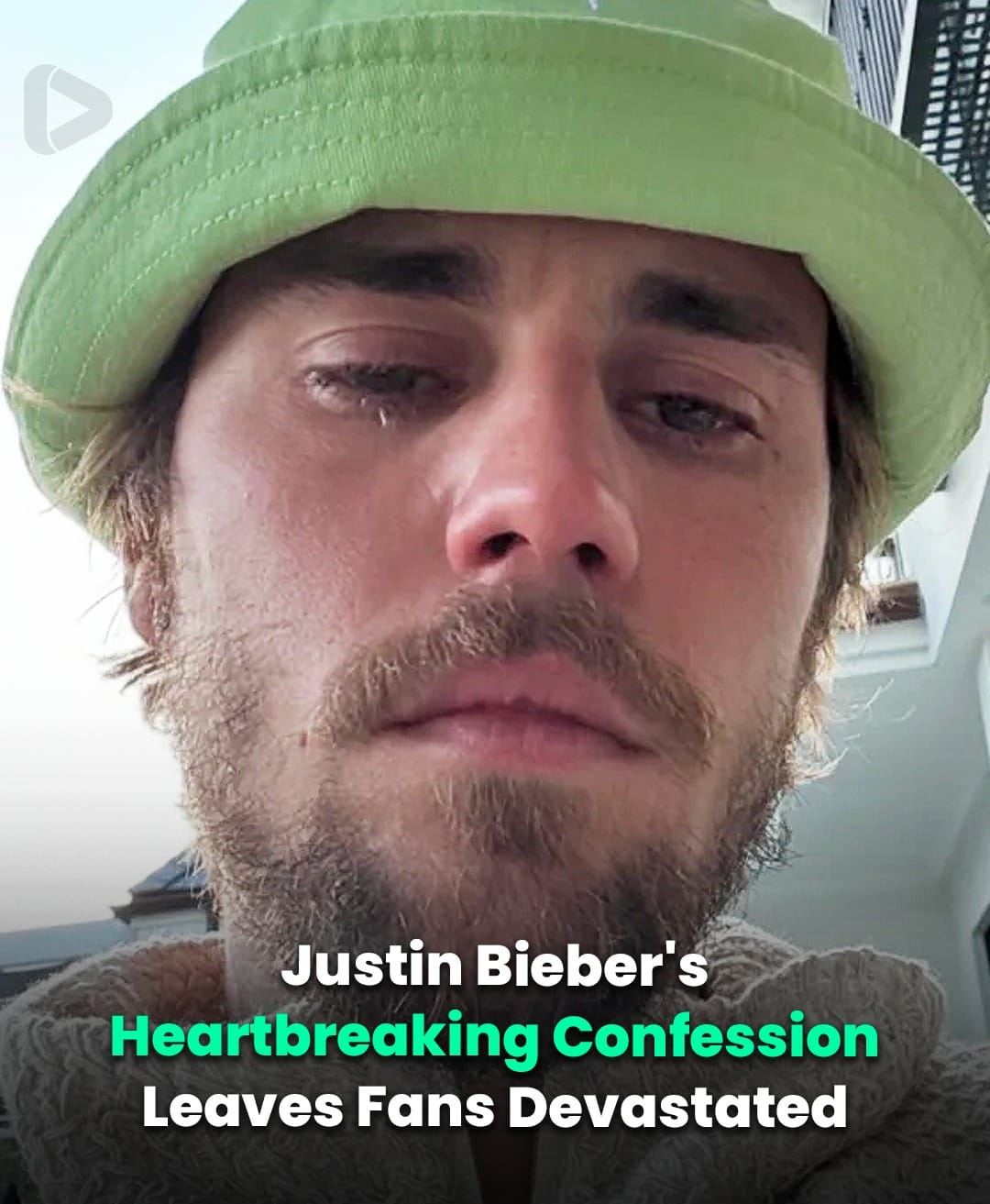 Justin Bieber’s Fans Share Concern As Singer Breaks Silence On ‘All Of The Hurt’