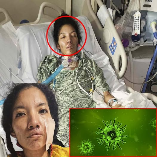 Mom of 2 Sons with Autism Has Limbs Amputated After Flesh-Eating Disease: ‘I Can’t Take Care of My Children’