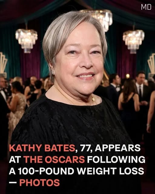Kathy Bates Shines at 77 with a Remarkable Health Transformation and Renewed Confidence